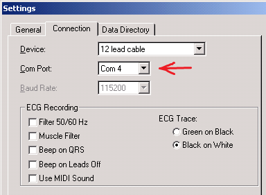 ECG connection settings in Cardioview